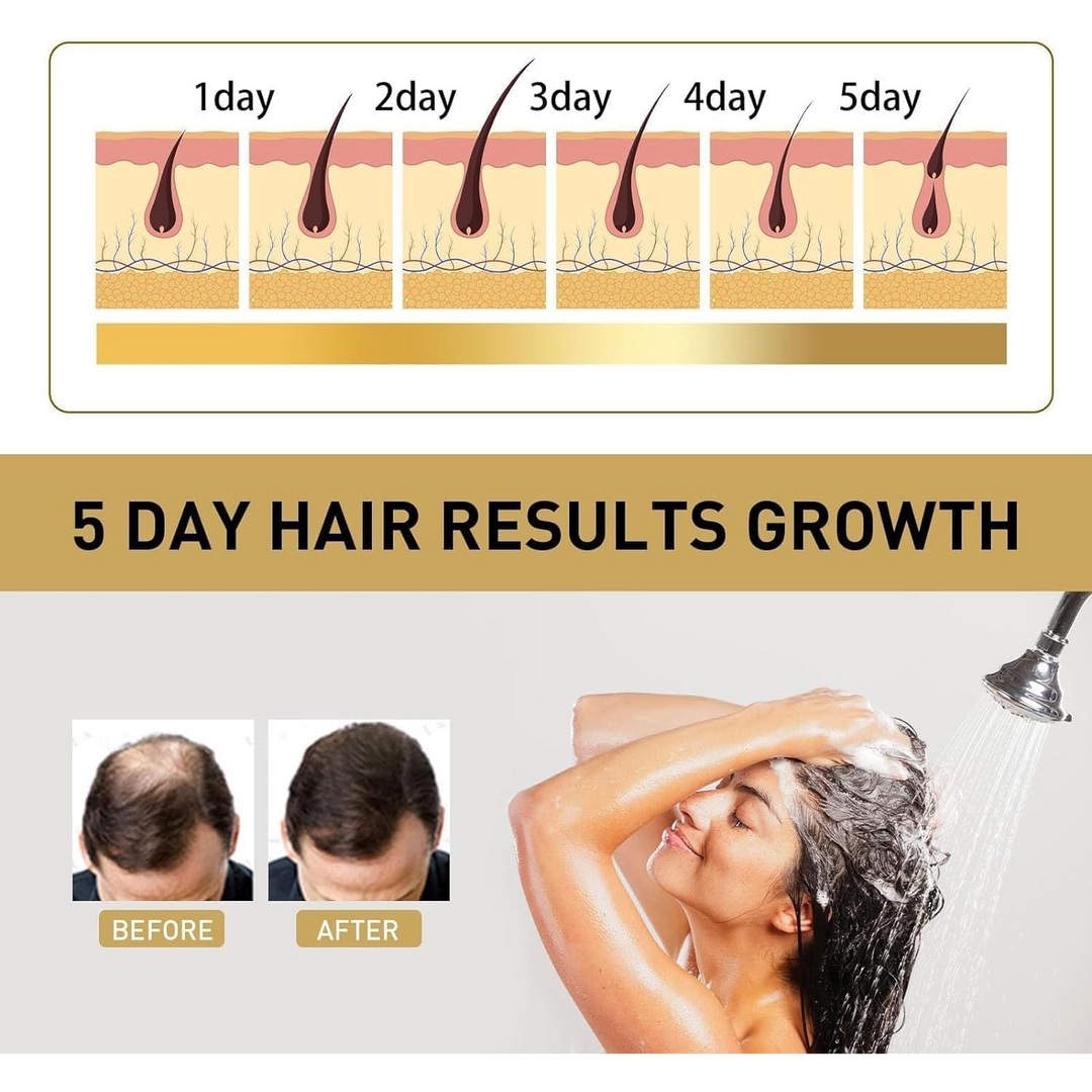 Sakura Japanese Shampoo For Hair Growth, Anti-Hair Loss And Anti-Dandruff - 300Ml