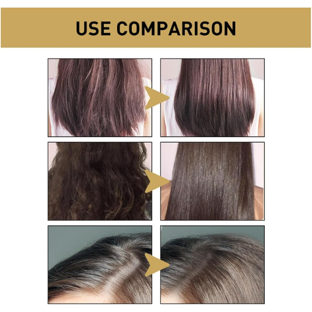 Sakura Japanese Shampoo For Hair Growth, Anti-Hair Loss And Anti-Dandruff - 300Ml