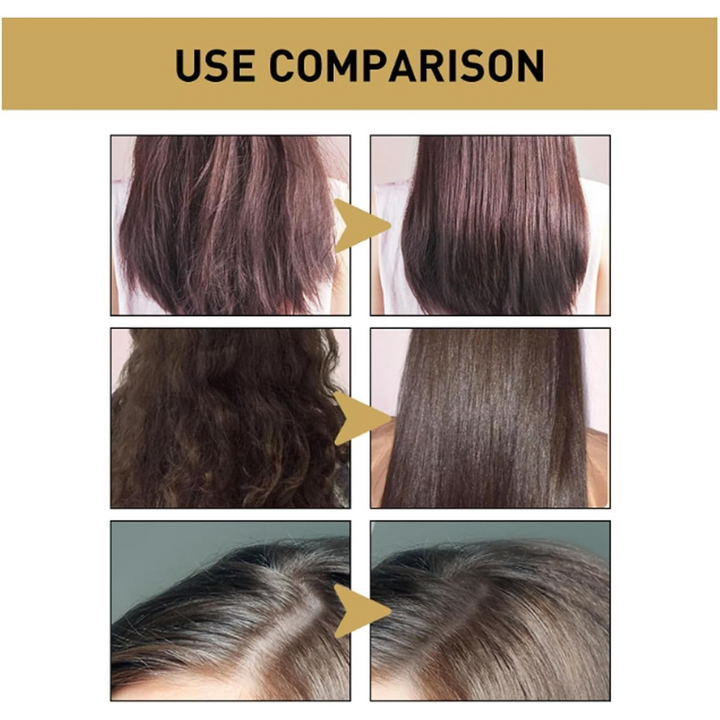 Sakura Japanese Shampoo For Hair Growth, Anti-Hair Loss And Anti-Dandruff - 300Ml