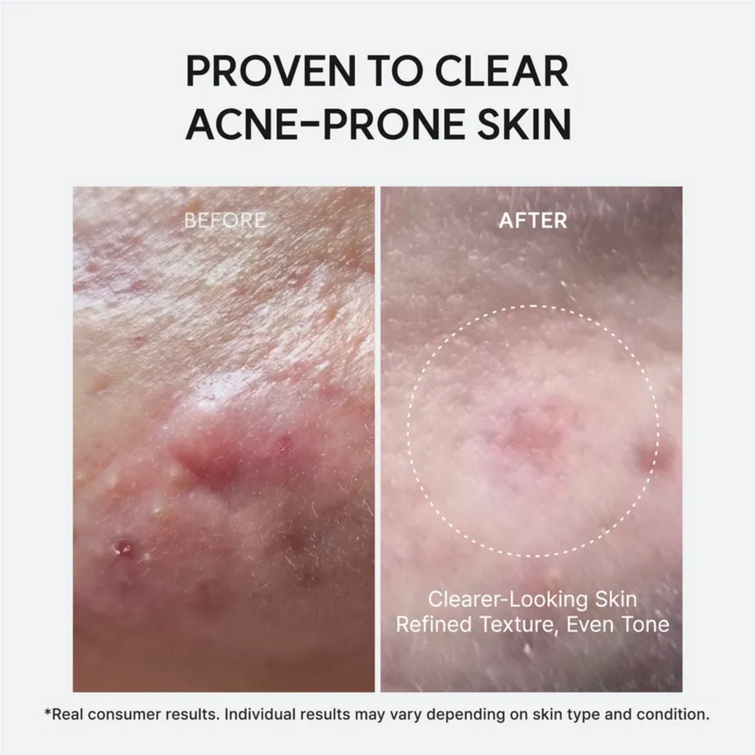 Arencia Skin Clarifying Booster Shot Trio - 3 Pcs
