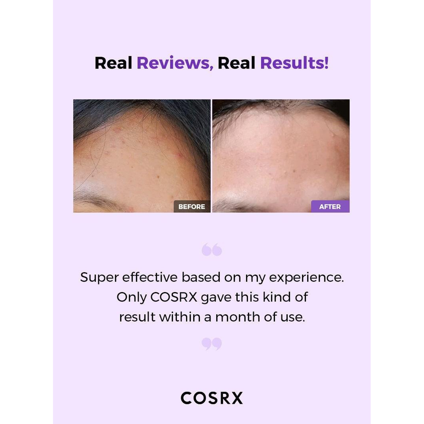 COSRX AHA/BHA Clarifying Treatment Toner COSRX AHA/BHA Clarifying Treatment Toner
