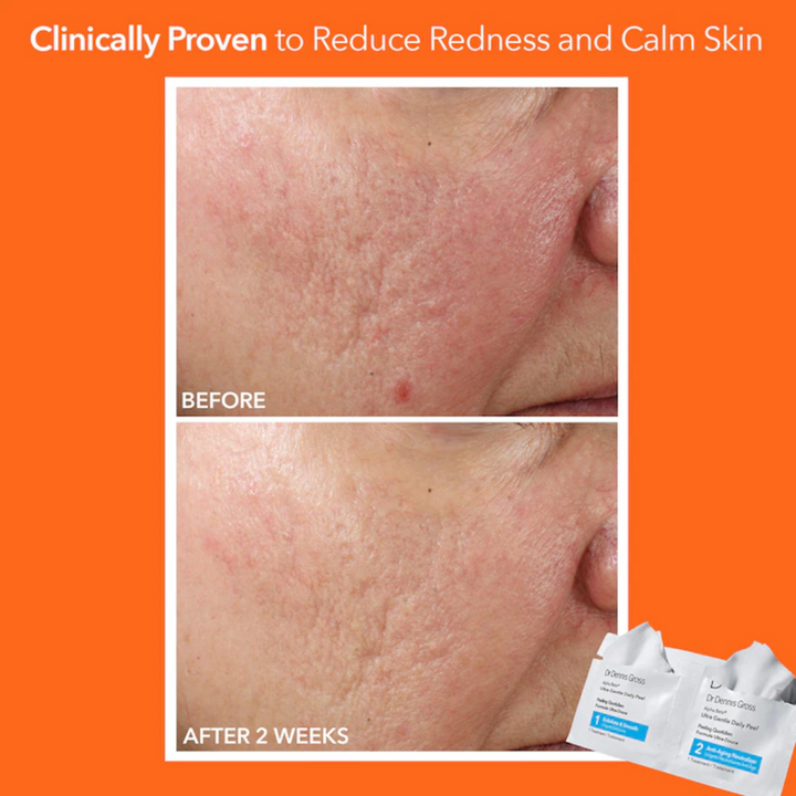 Dr. Dennis Gross Skincare Alpha Beta Ultra Gentle Daily Peel 3 Treatments