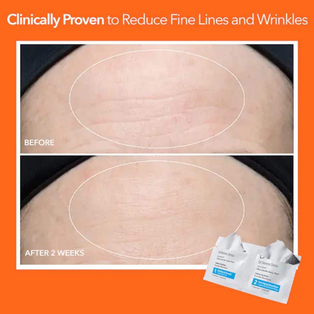 Dr. Dennis Gross Skincare Alpha Beta Ultra Gentle Daily Peel 3 Treatments