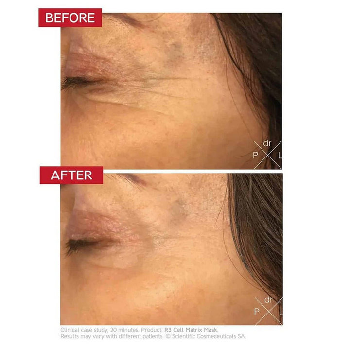 Dr. LEVY Switzerland R3 Cell Matrix Face Mask