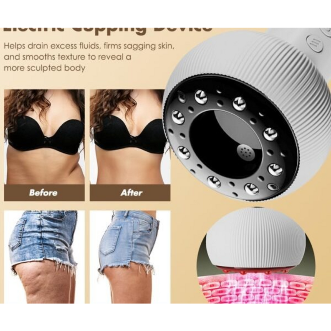 MDHL Smart Cupping and Massager Device