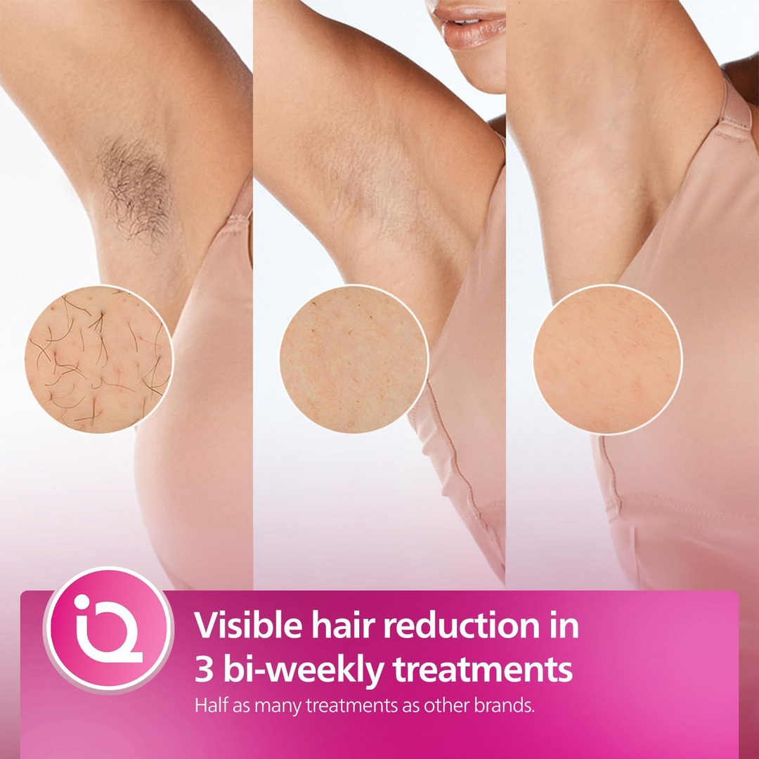 Philips Lumea 8000 IPL Hair Removal Device
