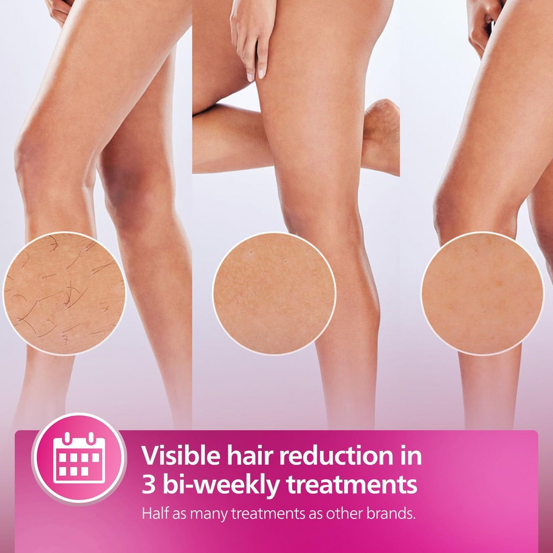 Philips Lumea 8000 IPL Hair Removal Device