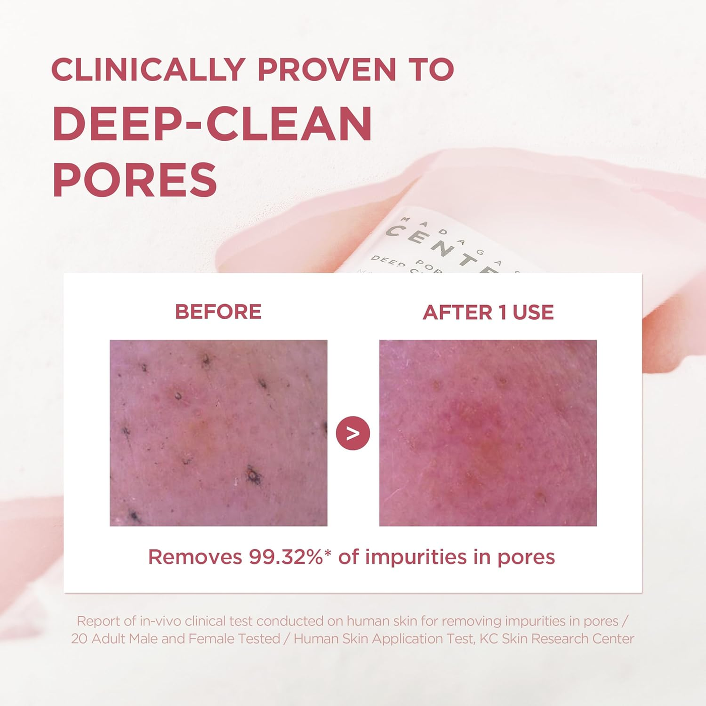 SKIN1004 Madagascar Centella Poremizing Deep Cleansing Foam SKIN1004 Madagascar Centella Poremizing Deep Cleansing Foam