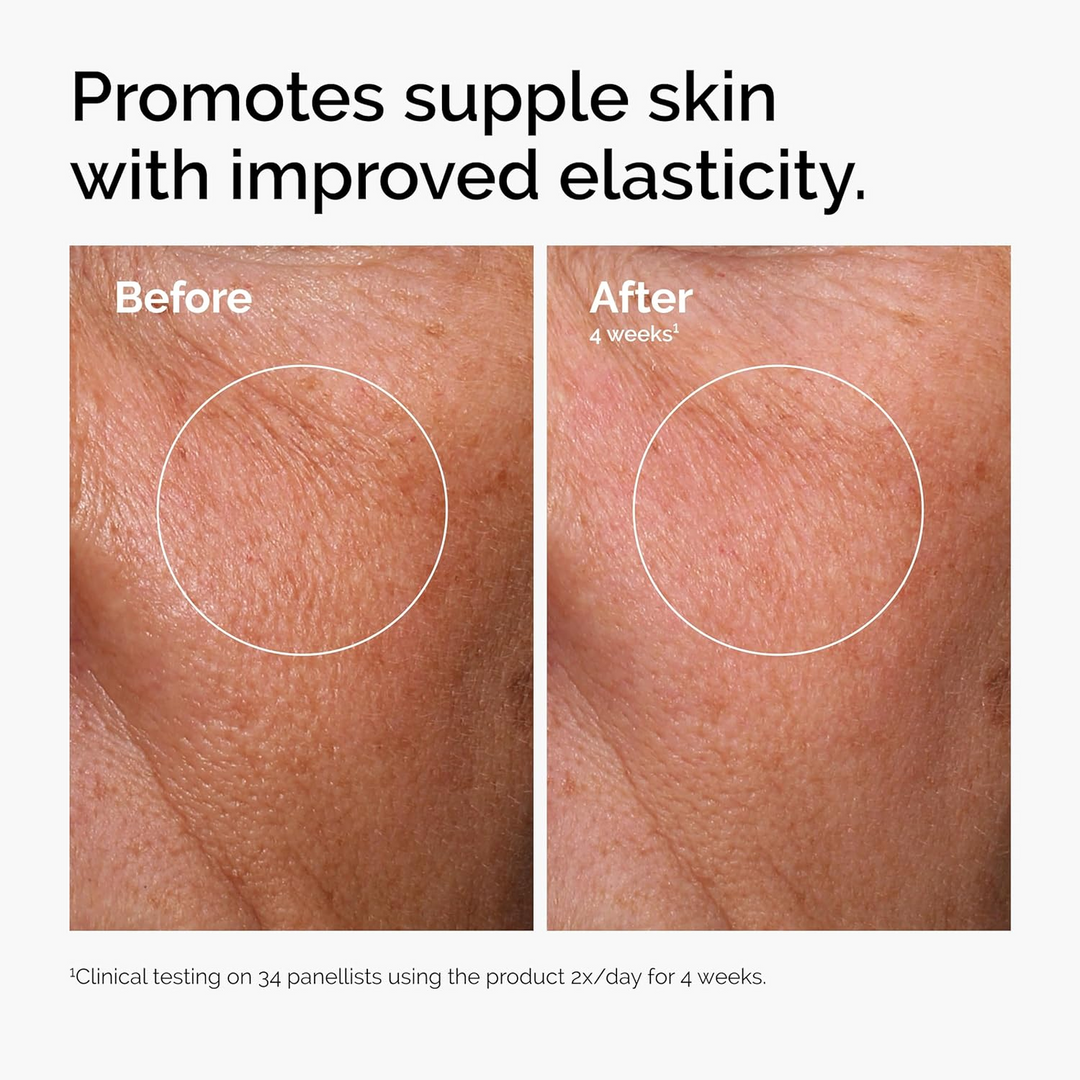 The Ordinary Hyaluronic ACID 2% &amp; B5 With Ceramides