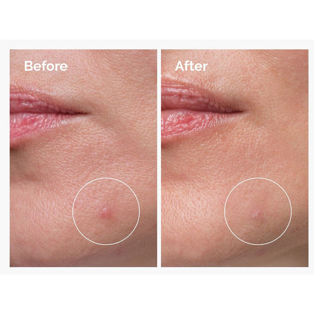 The Ordinary Sulfur 10% Powder-to-cream Concentrate