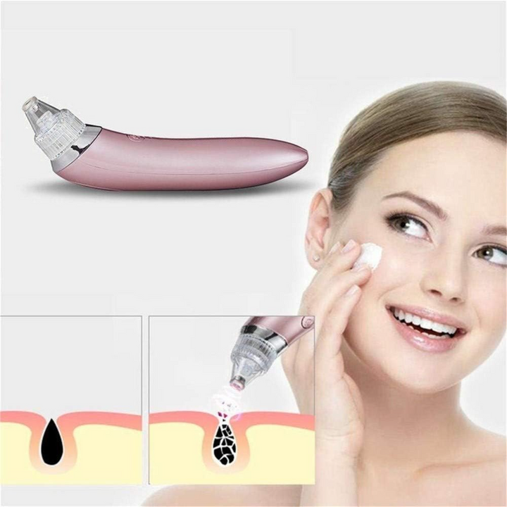 Xinshiji Weed Removal Device